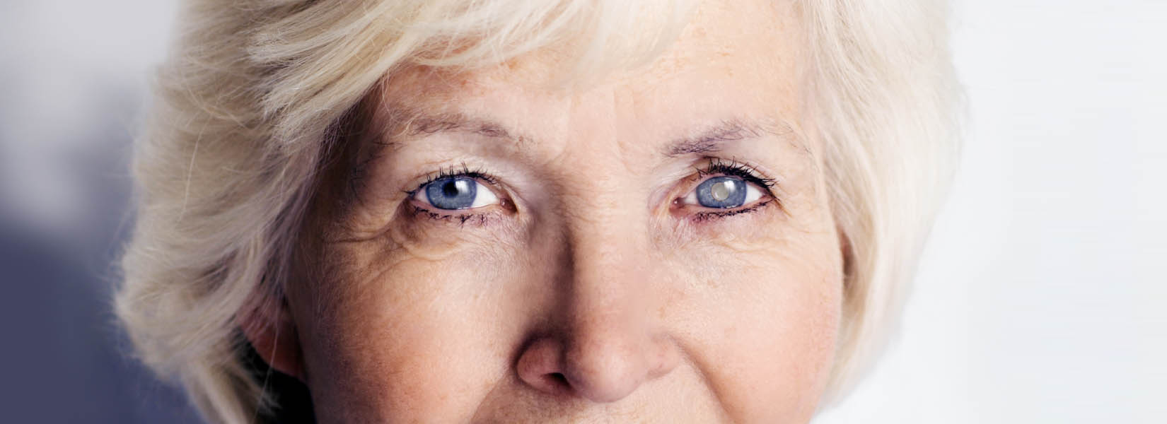 Cataract Surgery in Downtown Seattle